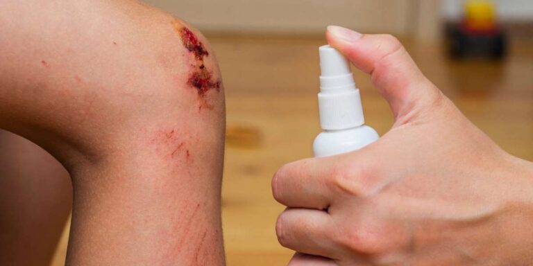 sebgyógyító spray